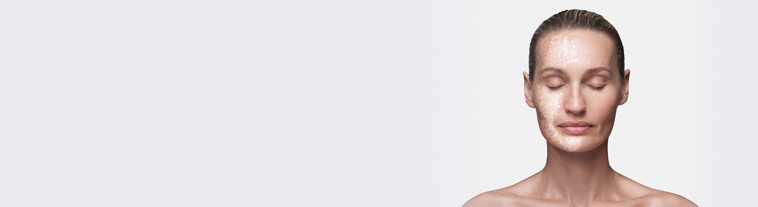 Peeling - mesoestetic.dk